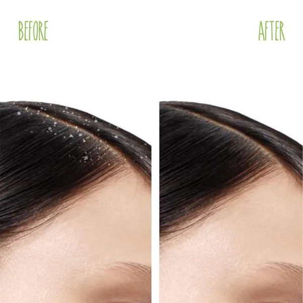 Matrix Biolage advanced, Scalppure shampoo 200ml