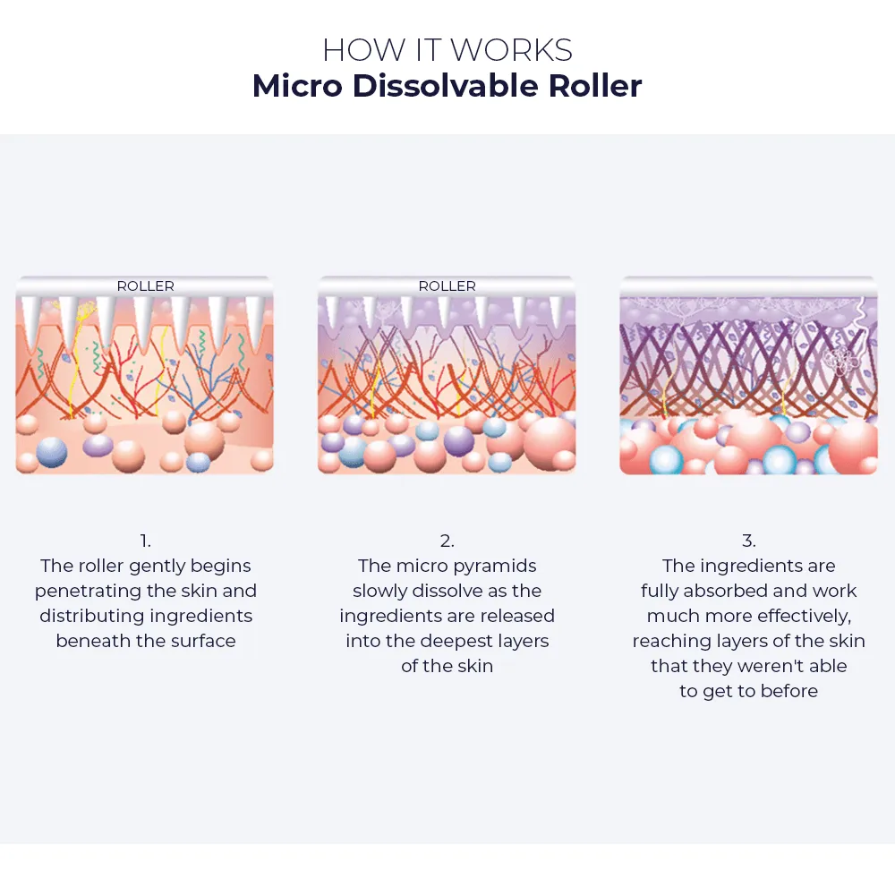 Micro Roller Kit (Free Retinol Oil, Hyaluronic Serum & Large Collagen Peel Mask)
