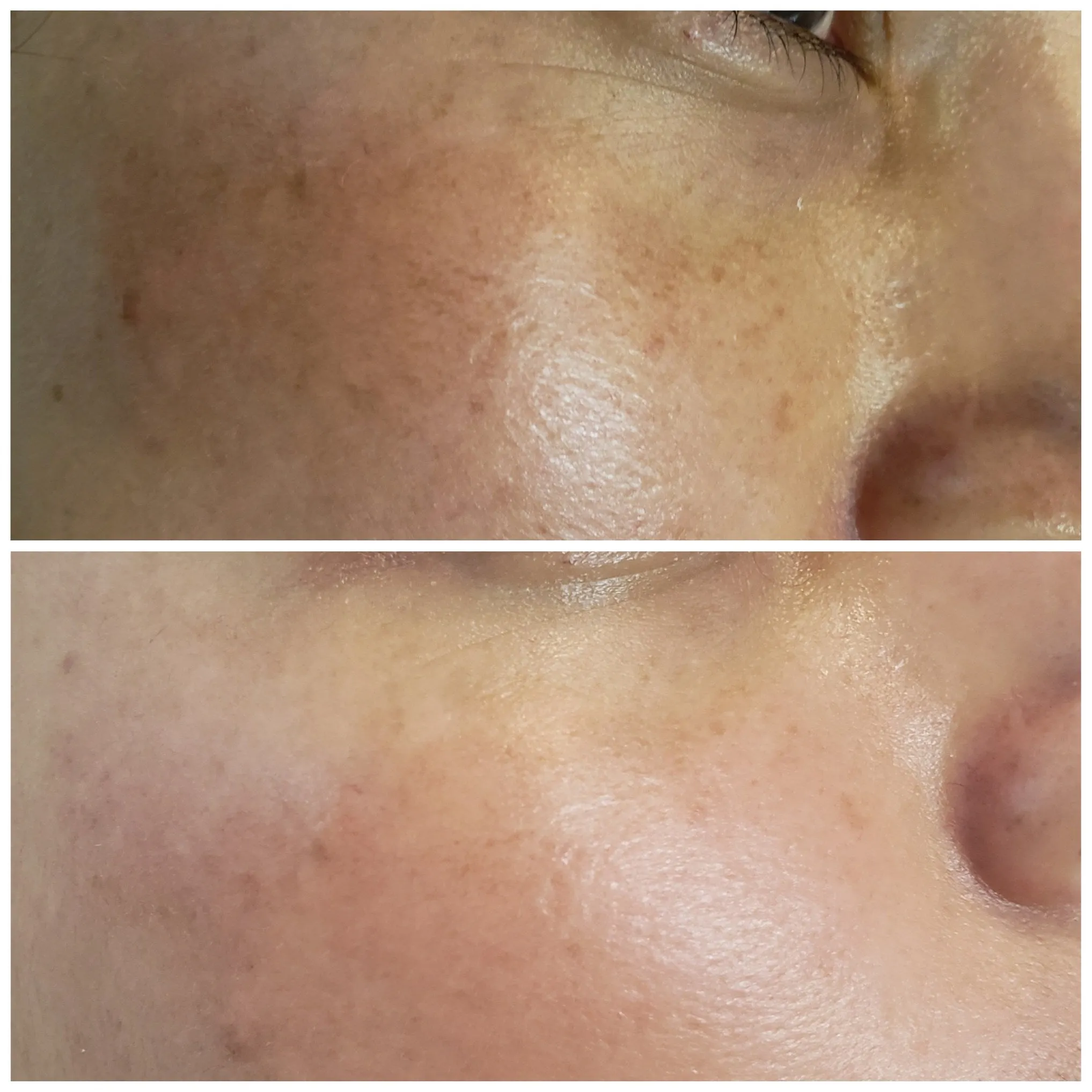 Rena Levi’s Deep Herbal Peel Kit   (PRO)