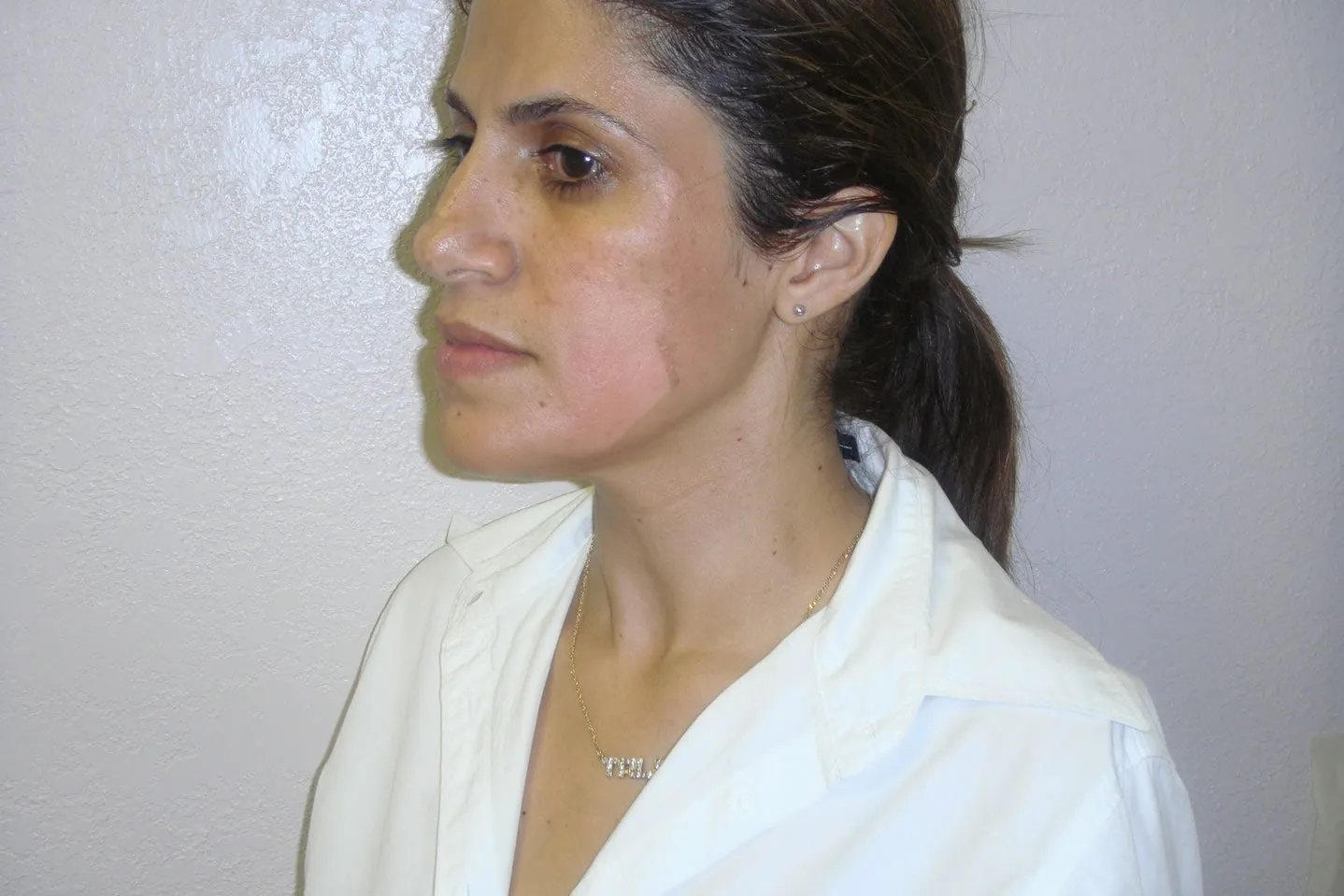 Rena Levi’s Deep Herbal Peel Kit   (PRO)